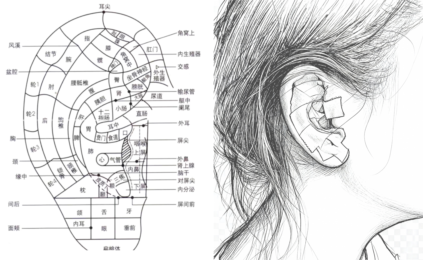 download?name=4+%E9%92%9F%E6%B0%8F%E8%80%B3%E7%A9%B4%E6%8E%92%E8%83%86%E7%BB%93%E7%9F%B3%E7%96%97%E6%B3%95.jpg&sig=1769136631%3Afd77796d75878dd02e92d28355de9571102f84a0ce4d5b3315db629a54af5eec