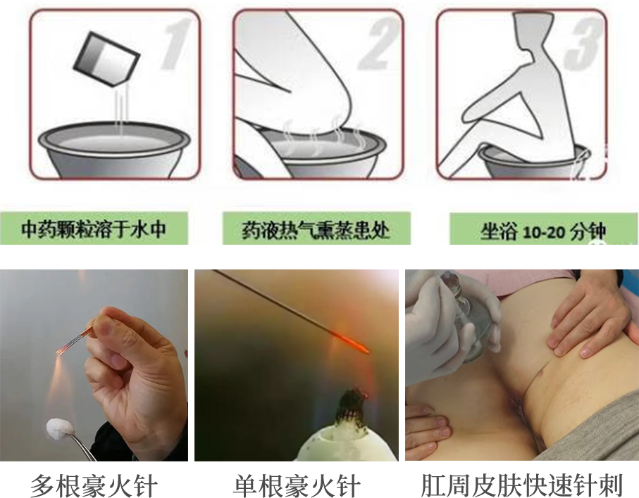 download?name=46.%E6%AD%A2%E7%97%92%E6%B1%A4%E8%81%94%E5%90%88%E7%81%AB%E9%92%88%E6%B2%BB%E7%96%97%E8%82%9B%E5%91%A8%E7%98%99%E7%97%92%E7%97%87%E7%9A%84%E6%8A%80%E6%9C%AF%E6%8E%A8%E5%B9%BF++%E5%88%98%E6%A0%91%E9%9B%B7.png&sig=1769155438%3A3d92025e27986f4a90cdfc244a96cb174d8285f833d3d17e987d398b9c11d356